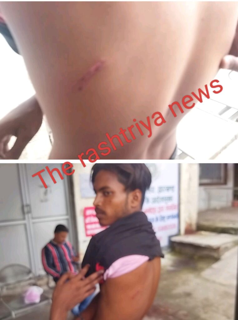 रविदास गुट के युवक ने विकास गुट के युवक पर किया चापड़ से हमला।